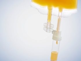 IV Vitamin Therapy