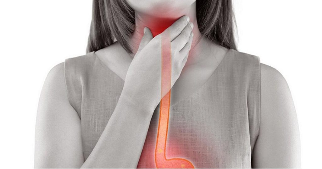 Esophageal Cancer Signs And Symptoms: Recognizing Early Warning Signs ...